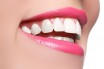 Наиболее востребованные косметические стоматологические процедуры